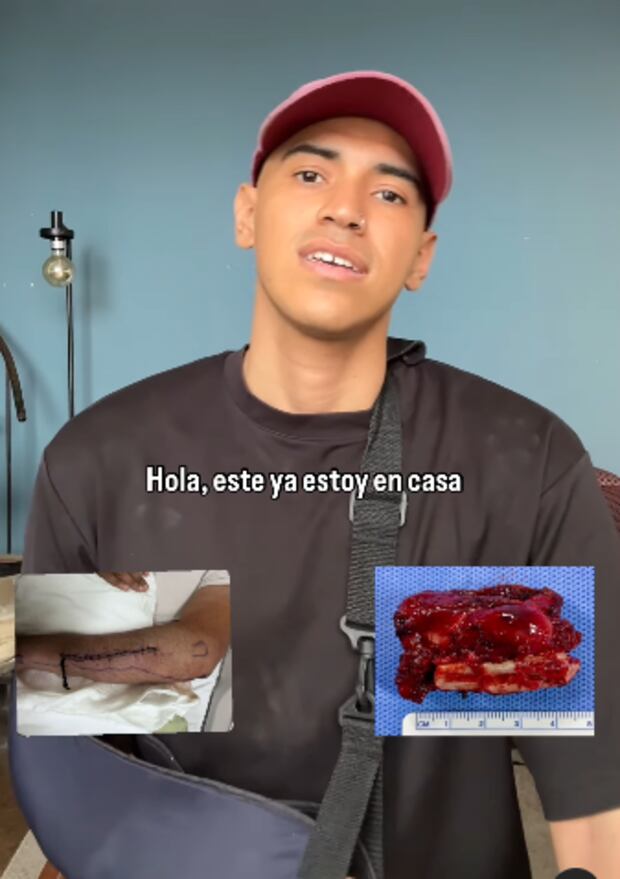 Hijo de Bettina Oneto fue operado de cáncer