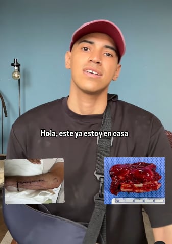 Hijo de Bettina Oneto fue operado de cáncer