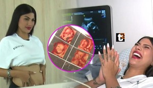 Brunella Torpoco confirma que se convertirá en mamá y se enteró del sexo de su bebé en televisión