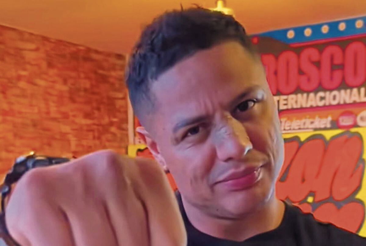 Jonathan Maicelo soprendió a miles de usuarios tras su rinoplastia.