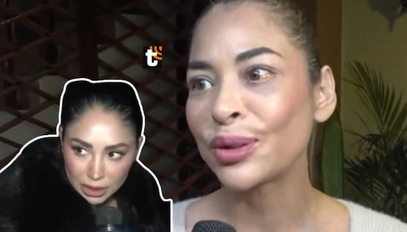 TROME- ¿Melanie ‘rompió palitos’ con Franco? Lanza fuerte declaración: “Si ella ha decidido no ser consecuente...”
