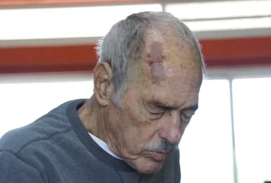 Don García con el parche luego de su caída (Foto: Andrés García /YouTube)