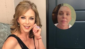 Actriz mexicana Laura Flores sufre microinfarto cerebral tras someterse a tratamiento estético: “Estoy viva de milagro” | VIDEO