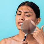 Cáncer de piel: la regla ABCDE para detectarlo a tiempo, sobre todo en verano