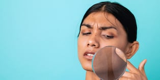 Para protegerse del sol, aplica bloqueador con protección 50 o más varias veces al día. También usa lentes con protección UV y sombreros de ala ancha. Foto: Istock