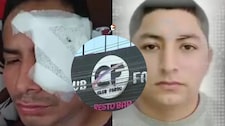 ¡Brutal ataque en discoteca de Carabayllo! Cortan el rostro a joven con una botella de cerveza y agresor fue liberado