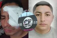 ¡Brutal ataque en discoteca de Carabayllo! Cortan el rostro a joven con una botella de cerveza y agresor fue liberado