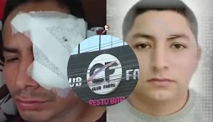 ¡Brutal ataque en discoteca de Carabayllo! Cortan el rostro a joven con una botella de cerveza y agresor fue liberado