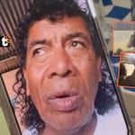 Cachay denunciará a sujeto que lo agredió brutalmente en show: “Que se vaya preso. Me ha querido matar”
