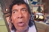 Cachay denunciará a sujeto que lo agredió brutalmente en show: “Que se vaya preso. Me ha querido matar”