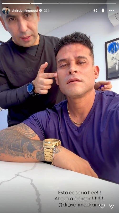 Domínguez se somete a retoquitos y sorprende con radical cambio a días de su boda con Karla Tarazona.