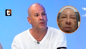 Ricky Trevitazo preocupa a sus seguidores tras aparecer con el rostro hinchado: “Ayer estaba peor”