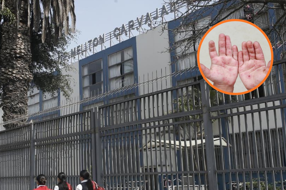 Detectan presencia virus Coxsackie en cuatro aulas de conocido colegio.