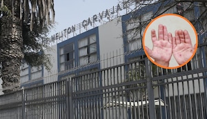 Lince: Suspenden clases en colegio Melitón Carvajal por el brote de virus de Coxsackie | VIDEO