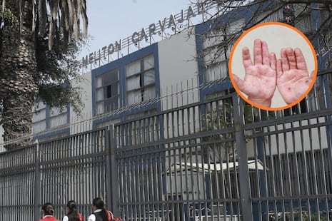 Lince: Suspenden clases en colegio Melitón Carvajal por el brote de virus de Coxsackie | VIDEO