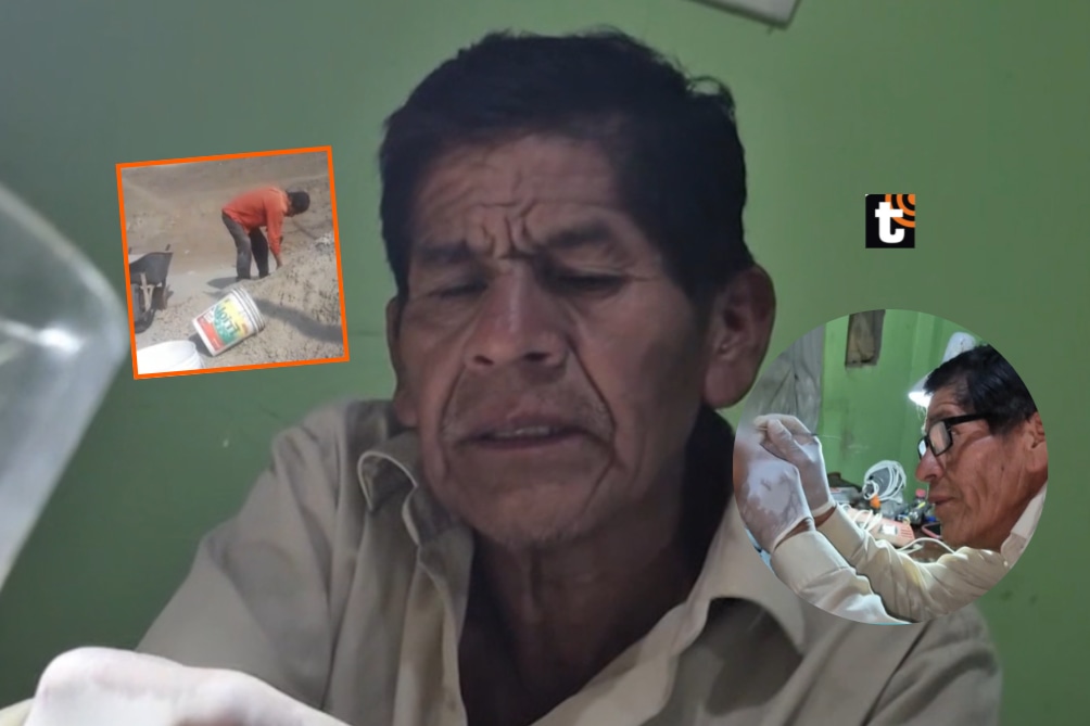 Albañil ejerce como dentista en sus ratos libres en Ventanilla.