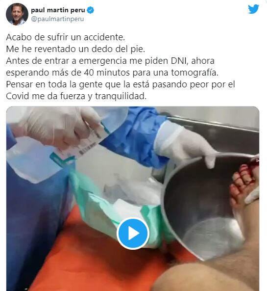 Paul Martin reportó en Twitter que sufrió accidente. (Foto: @paulmartinactor)
