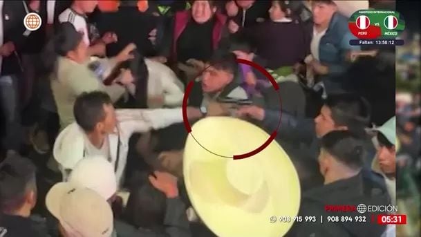 Rondero resulta herido tras disparo en fiesta de La Libertad. Foto: América Noticias