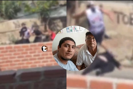 ¡Barristas lo golpearon y le lanzaron una roca al rostro! Joven quedó grave tras brutal ataque en Chosica
