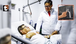 Dilbert Aguilar revela su delicado estado de salud tras su intervención a la cadera: “Esta vez fue una operación compleja”