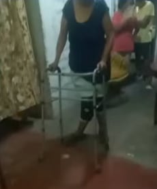 Abuelita sufre por negligencia médica en hospital Carrión