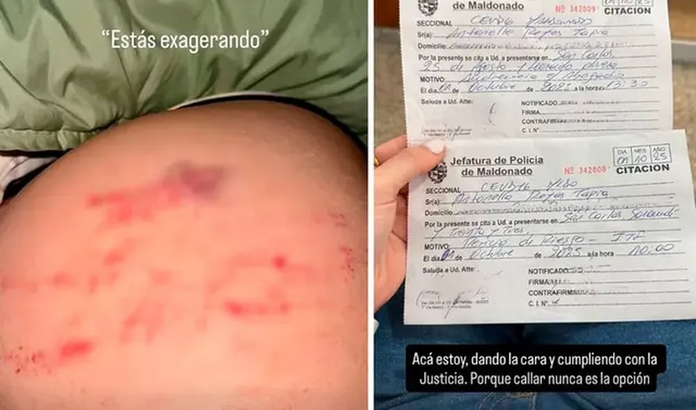 Joven muestra pruebas de la agresión que involucraría a Pablo Ceppelini. (Fuente: Instagram)