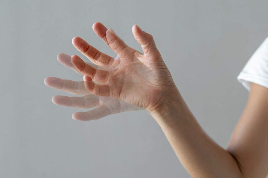 Mal se caracteriza por rigidez, temblor (en manos, brazos y piernas) y lentitud en los movimientos. Foto: ¡Stock.