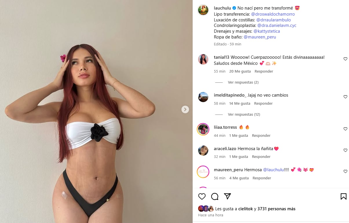 'La Uchulú' luego de someterse a nuevos 'arreglitos'.