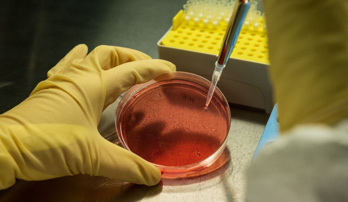 Estados Unidos viene investigando acerca del virus Merburg (Foto: referencial: AFP)