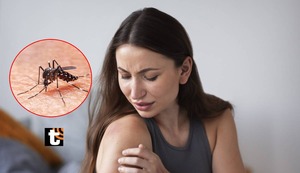 Dengue, la enfermedad que se llevó al ‘Ingeniero Bailarín’: ¿cuáles son los síntomas de la infección y a qué se debe el aumento de casos?