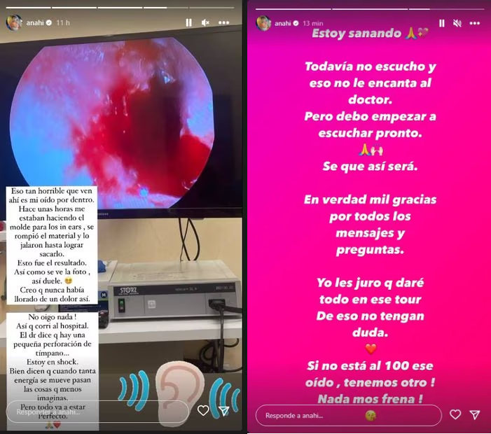 La cantante mexicana reveló qué ocurrió con su lesión y su futuro en la gira "Soy Rebelde tour" (Foto: Anahí / Instagram)