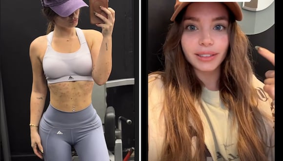 Flavia Laos presenta problemas de salud que se reflejan en su rostro