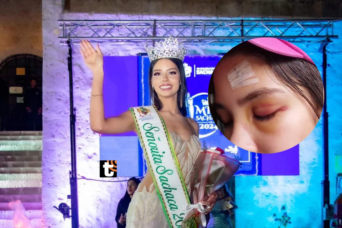 Angelina Bascom, Miss Sachaca 2024, denunció una salvaje agresión de parte de su pareja.