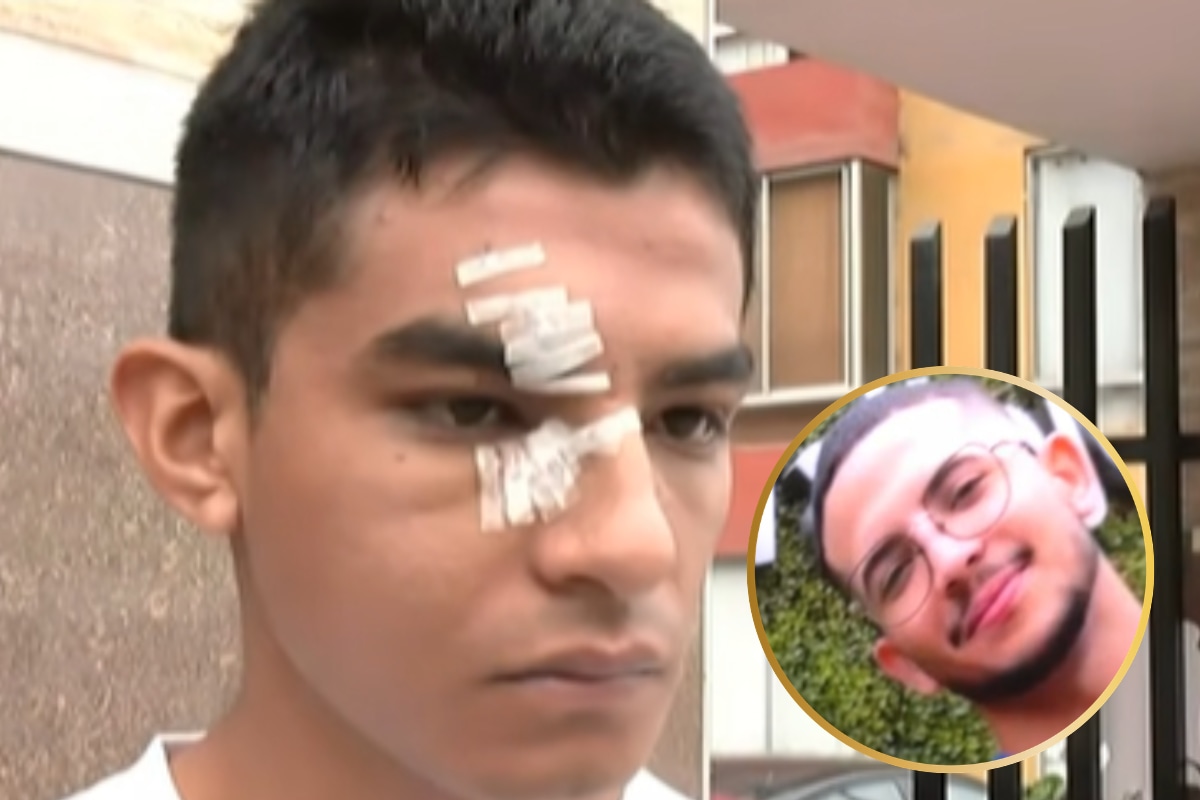 Estudiante denuncia que compañero le desfiguró el rostro a puñetes en patio de la UCV