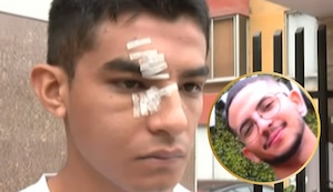 Estudiante denuncia que compañero le desfiguró el rostro a puñetes en patio de la UCV: “Con el vidrio de mis lentes me cortó la cara”