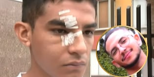 Estudiante denuncia que compañero le desfiguró el rostro a puñetes en patio de la UCV
