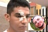 Estudiante denuncia que compañero le desfiguró el rostro a puñetes en patio de la UCV: “Con el vidrio de mis lentes me cortó la cara”