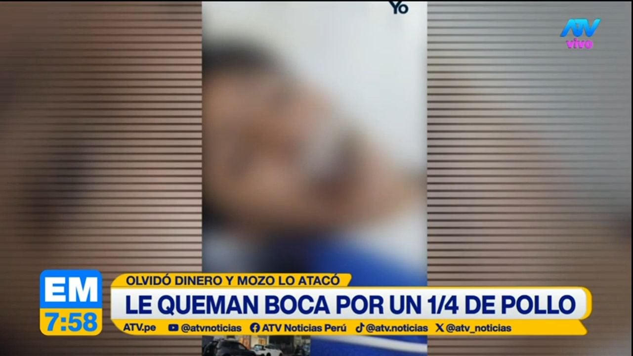 Adolescente de 17 años sufrió quemaduras en la boca tras ser atacado con carbón en pollería de Huancavelica. Foto: ATV