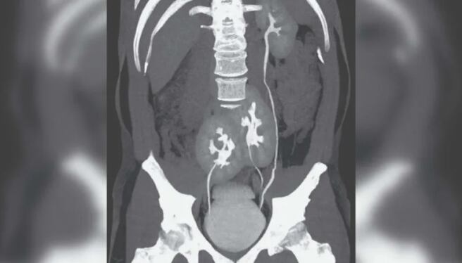 Foto: The New England Journal of Medicine