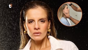 Ale Baigorria enfrenta una dolorosa afección y se somete a ‘retoquito’ en plena crisis con Said