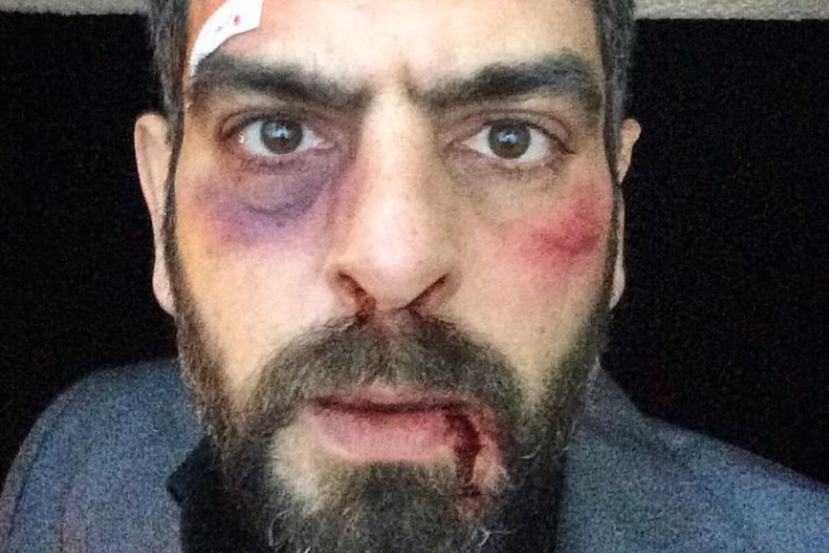 Mehmet Ali Nuroglu mostrando uno de sus trabajos en redes sociales. (Foto: Mehmet Ali Nuroglu / Instagram)