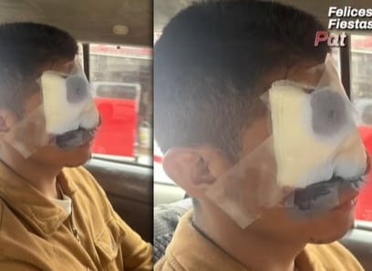 José Díaz Quispe fue agredido brutalmente dentro de la UCV
