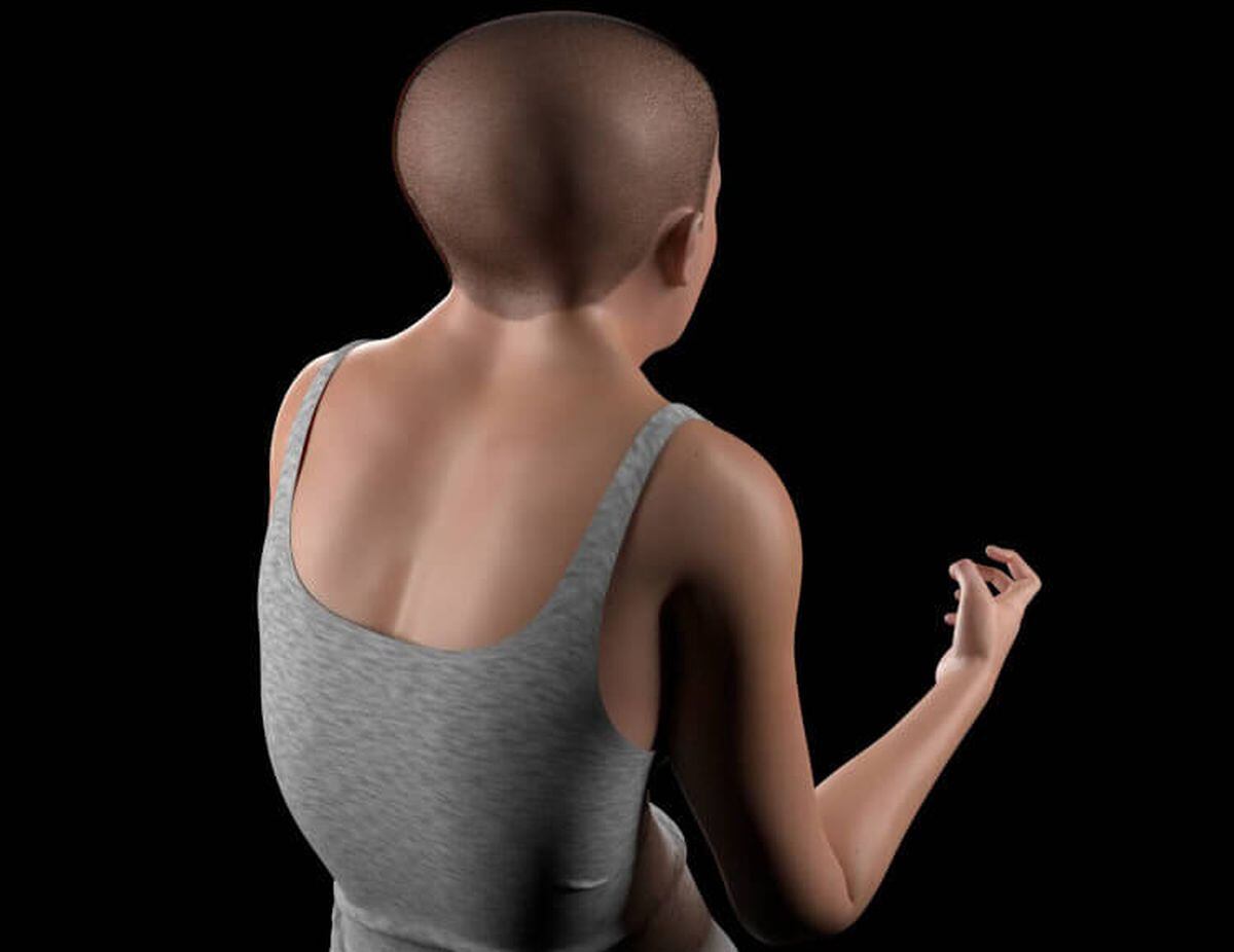 El humano en el año 3,000 podría tener joroba el cerebro más pequeño y el cráneo más duro (Foto: TollFreeForwarding)