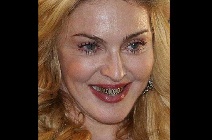 Madonna y sus dientes de oro y brillantes