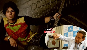 Pedro Suárez-Vértiz: ¿Qué enfermedad marcó su vida, cómo apareció, había posibilidad de curación? Médico neurólogo explica