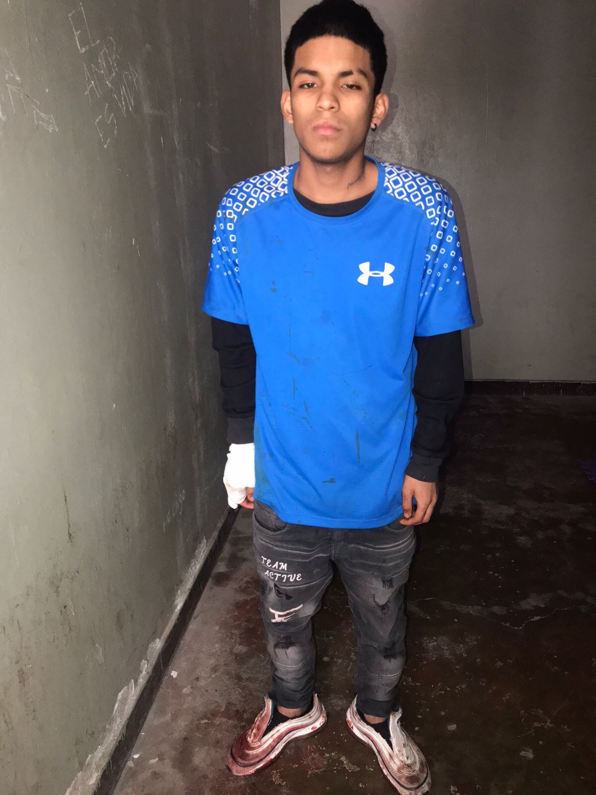 Mujer trans y dos acompañantes, de 18 y 25 años, se hirieron con cuchillos y cúter.