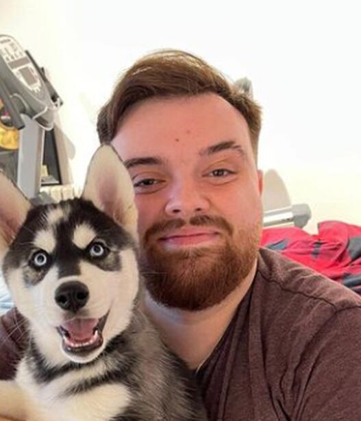 Ibai Llanos teme perder la visión (Foto: Ibai Llanos / Instagram)