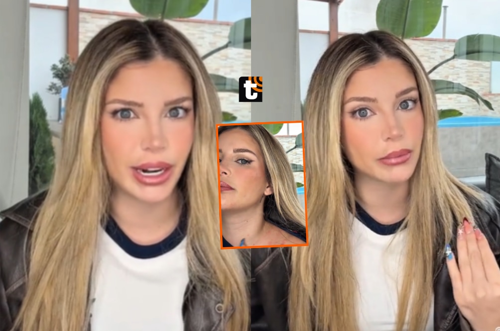 Flavia Laos confiesa que padece soriasis guttata, una enfermedad que no tiene cura.