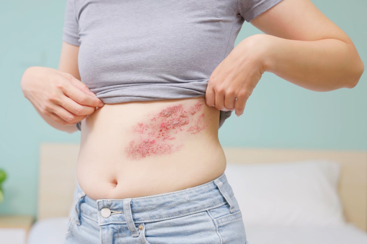 El geriatra Carlos Sandoval brinda información clave sobre el herpes zóster en el adulto mayor, una enfermedad que puede dejar secuelas dolorosas incluso después de desaparecer las lesiones. Foto: Istock.