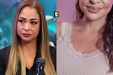 Melanie Martínez presume su nuevo rostro tras someterse a cirugía estética: así luce ahora